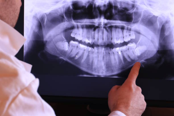 Best Emergency Gum Treatment in Elmwood Park, IL